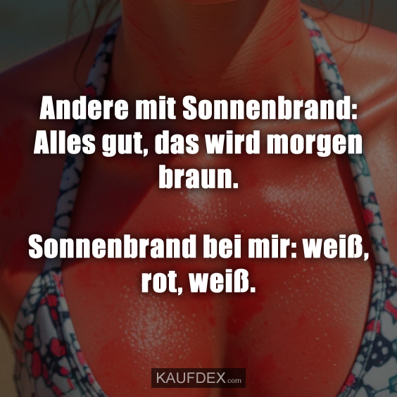 Andere mit Sonnenbrand: Alles gut, das wird…